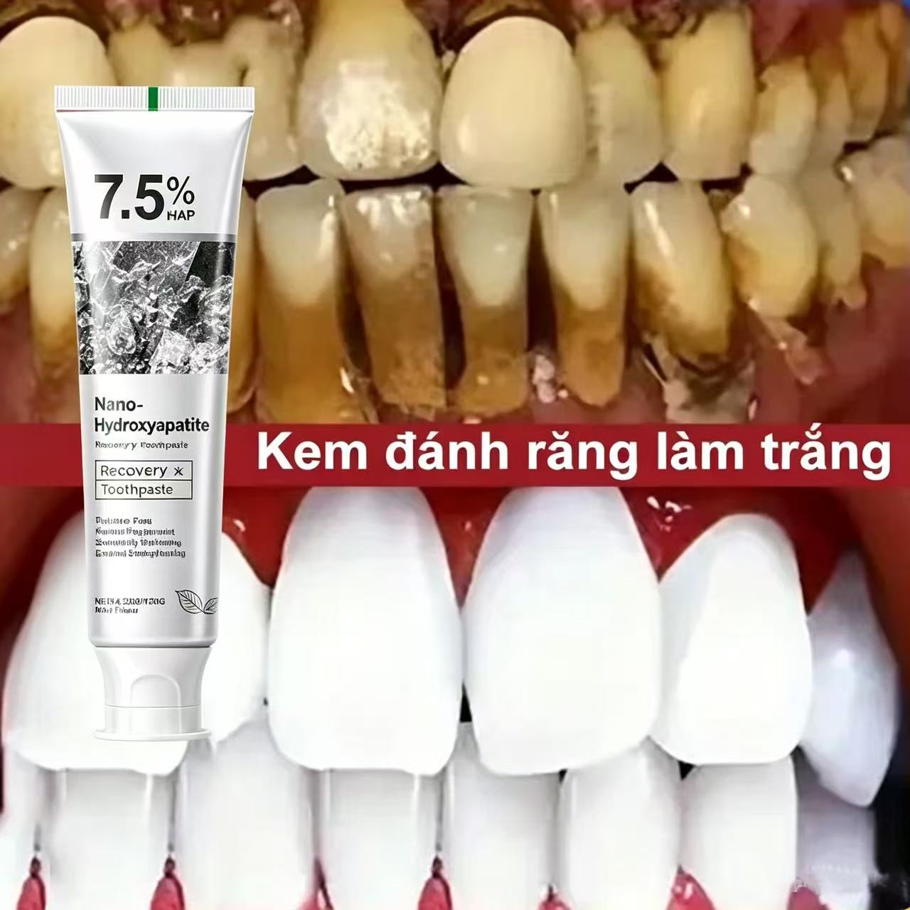 Teeth Whitening Best - Pasta de Dente Clareadora com 7,5%