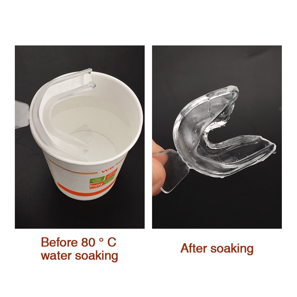 Protetor Bucal de Silicone (2- - Teeth Whitening With Braces avaliação e preço