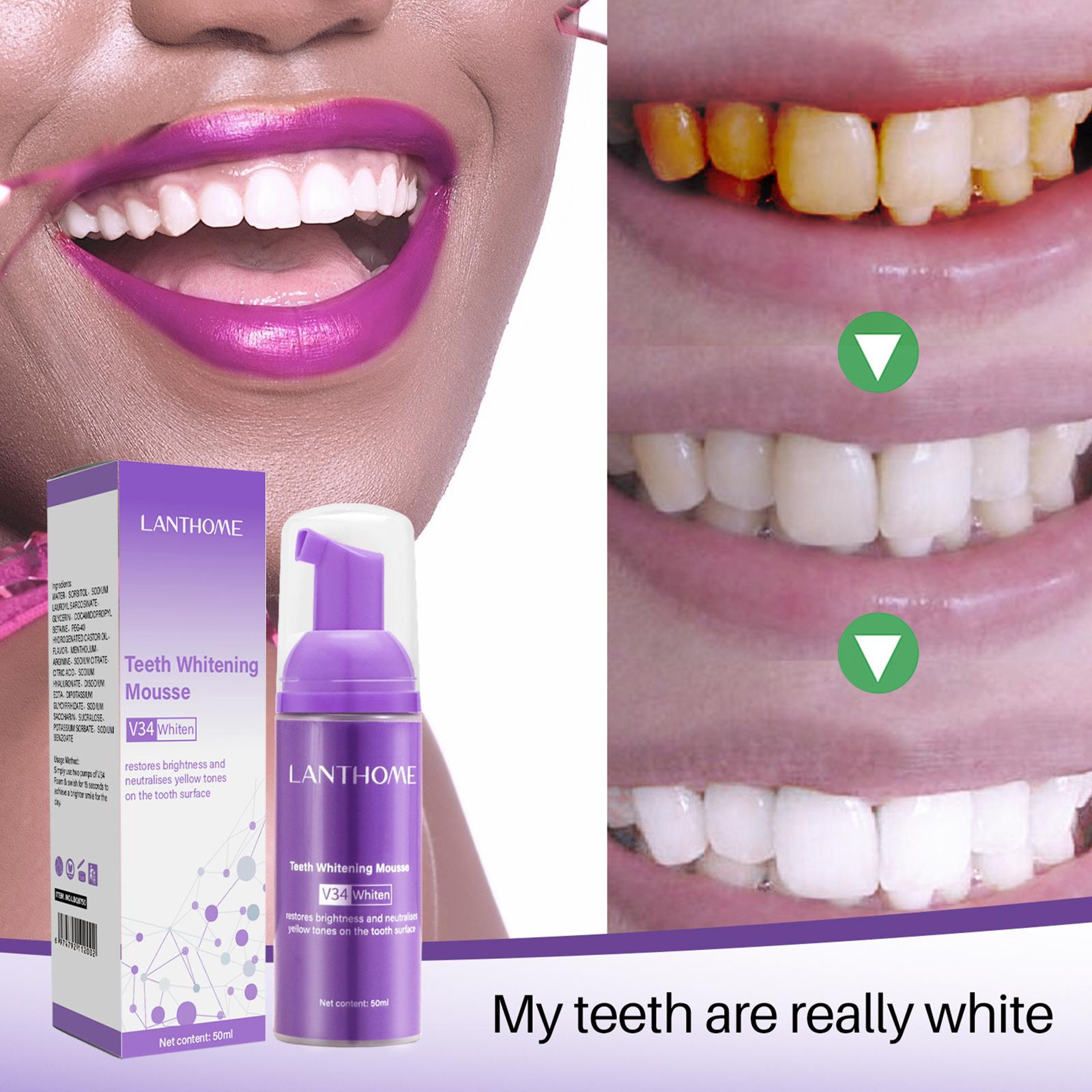 V34 mousse limpeza dos dentes  - Teeth Whitening Best avaliação e preço