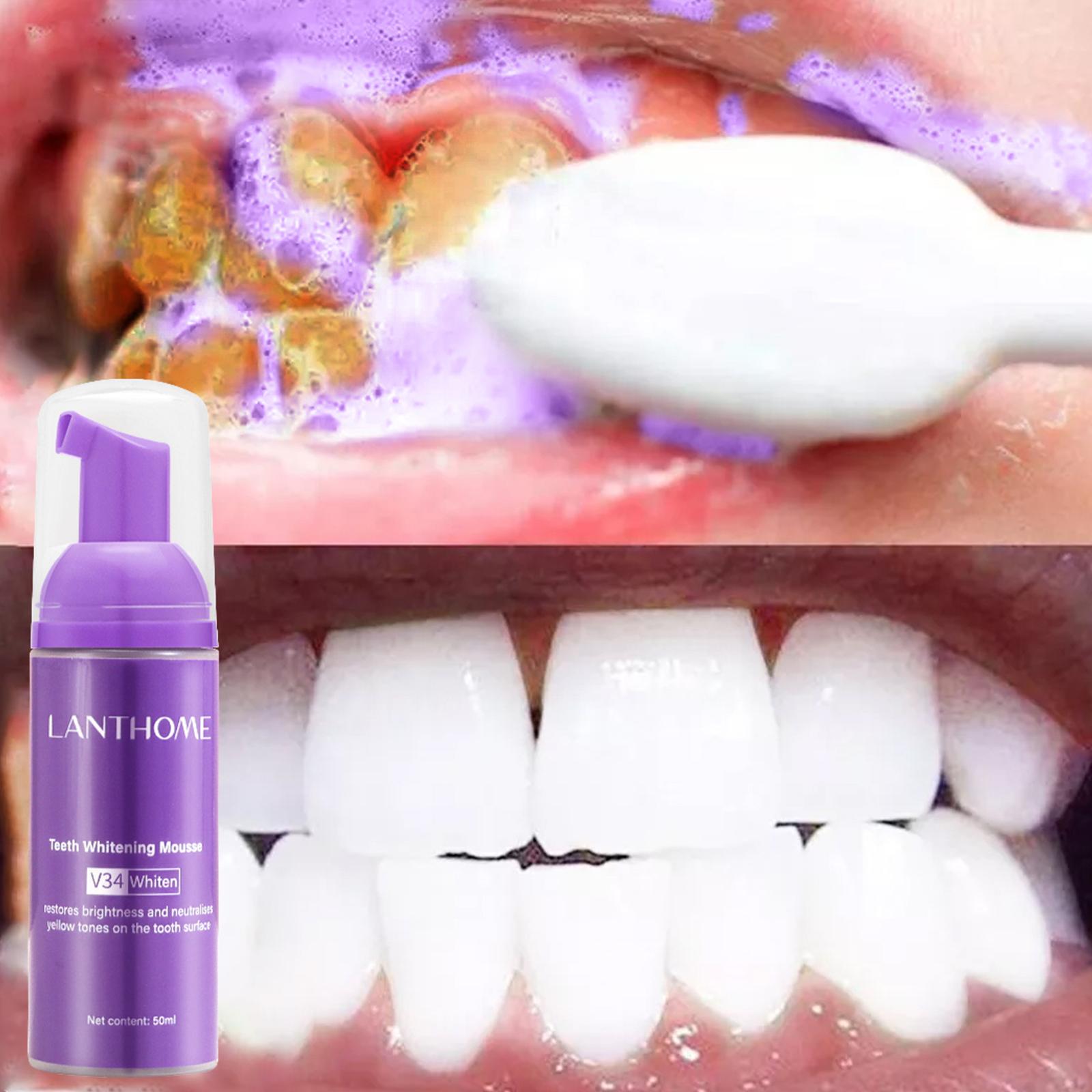 V34 mousse limpeza dos dentes  - Teeth Whitening Best avaliação e preço
