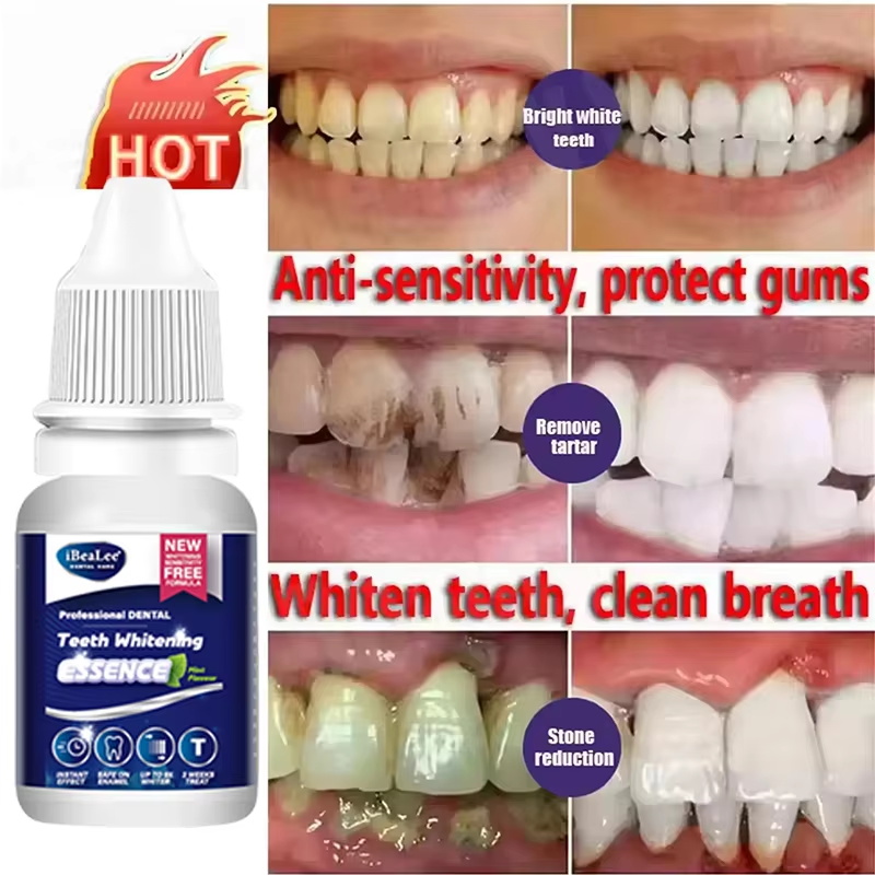 Essência para Clareamento Dent - Teeth Whitening Serum avaliação e preço