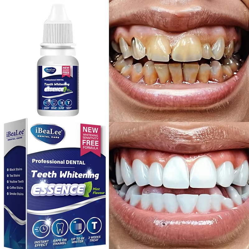 Essência para Clareamento Dent - Teeth Whitening Serum avaliação e preço