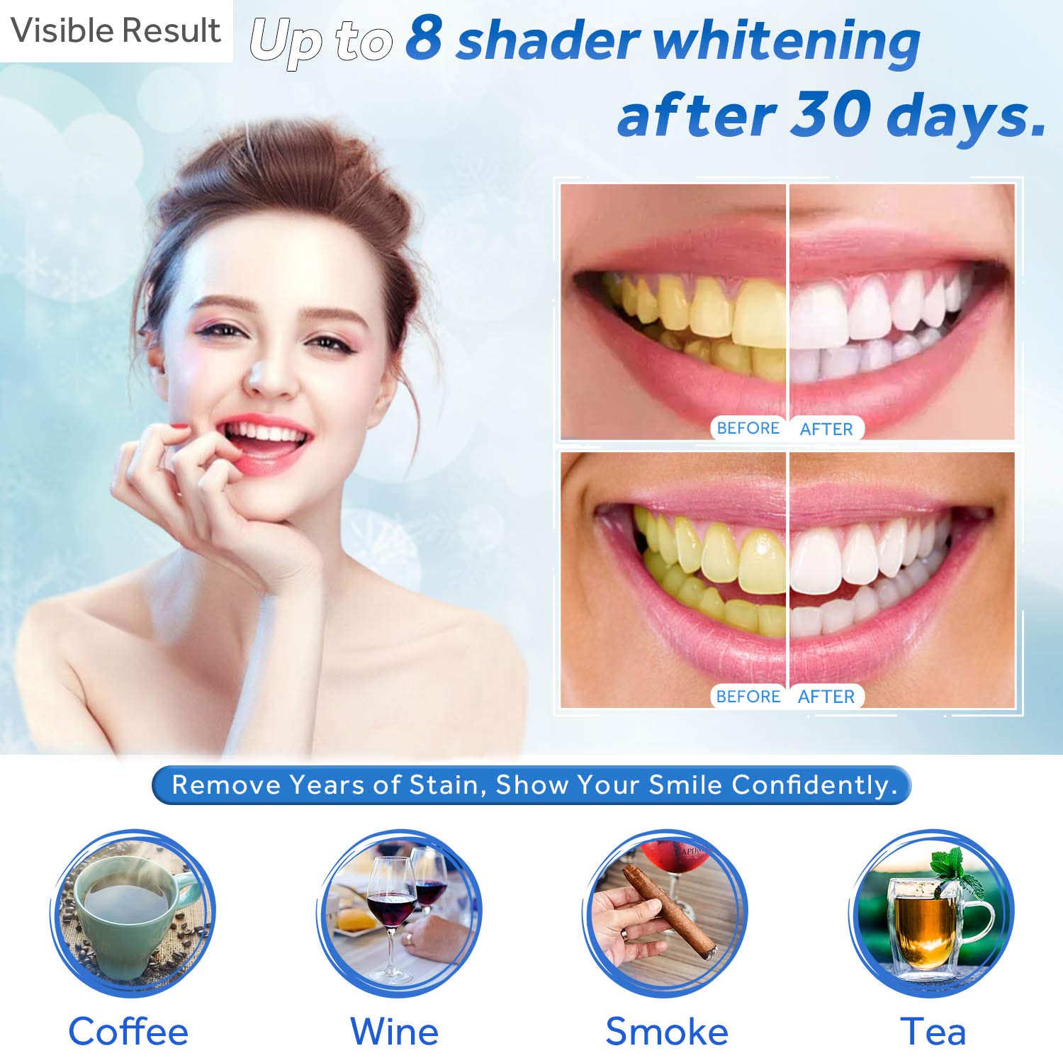 Seringa de recarga de gel para - Teeth Whitening For Trays avaliação e preço