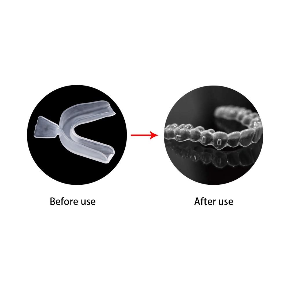 Protetor de dentes para bruxis - Teeth Whitening For Trays avaliação e preço