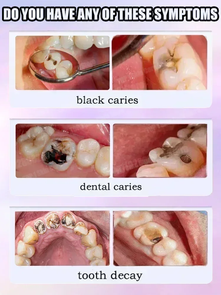 Vendas quentes mais vendidas,  - Teeth Whitening Best avaliação e preço