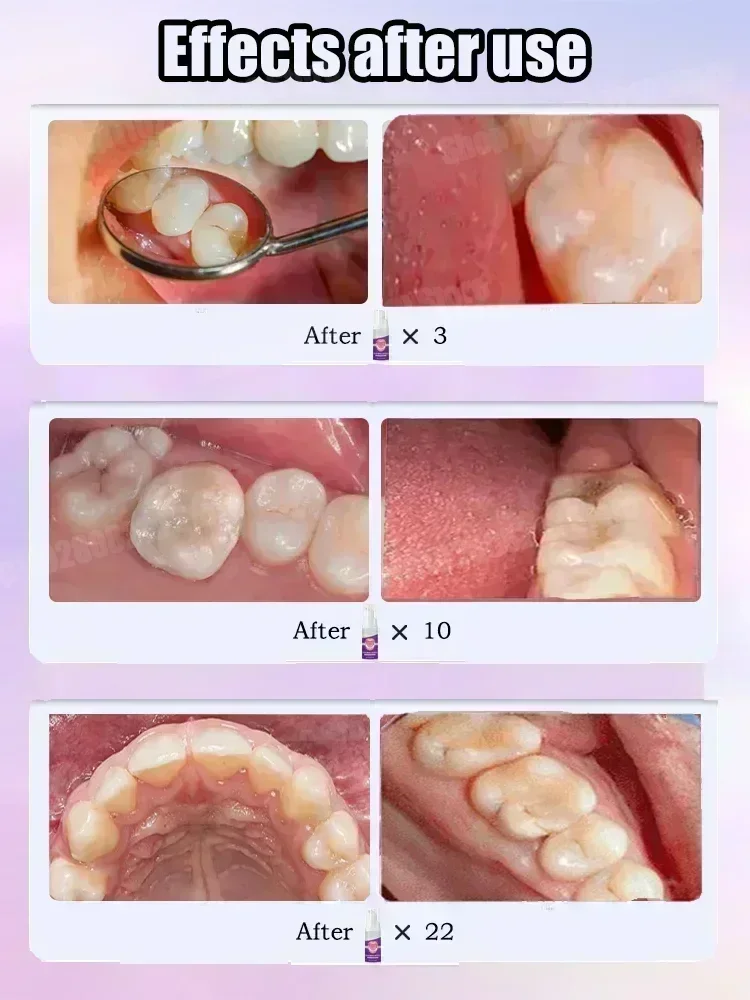 Pasta de Dente para Limpeza De - Teeth Whitening Best avaliação e preço